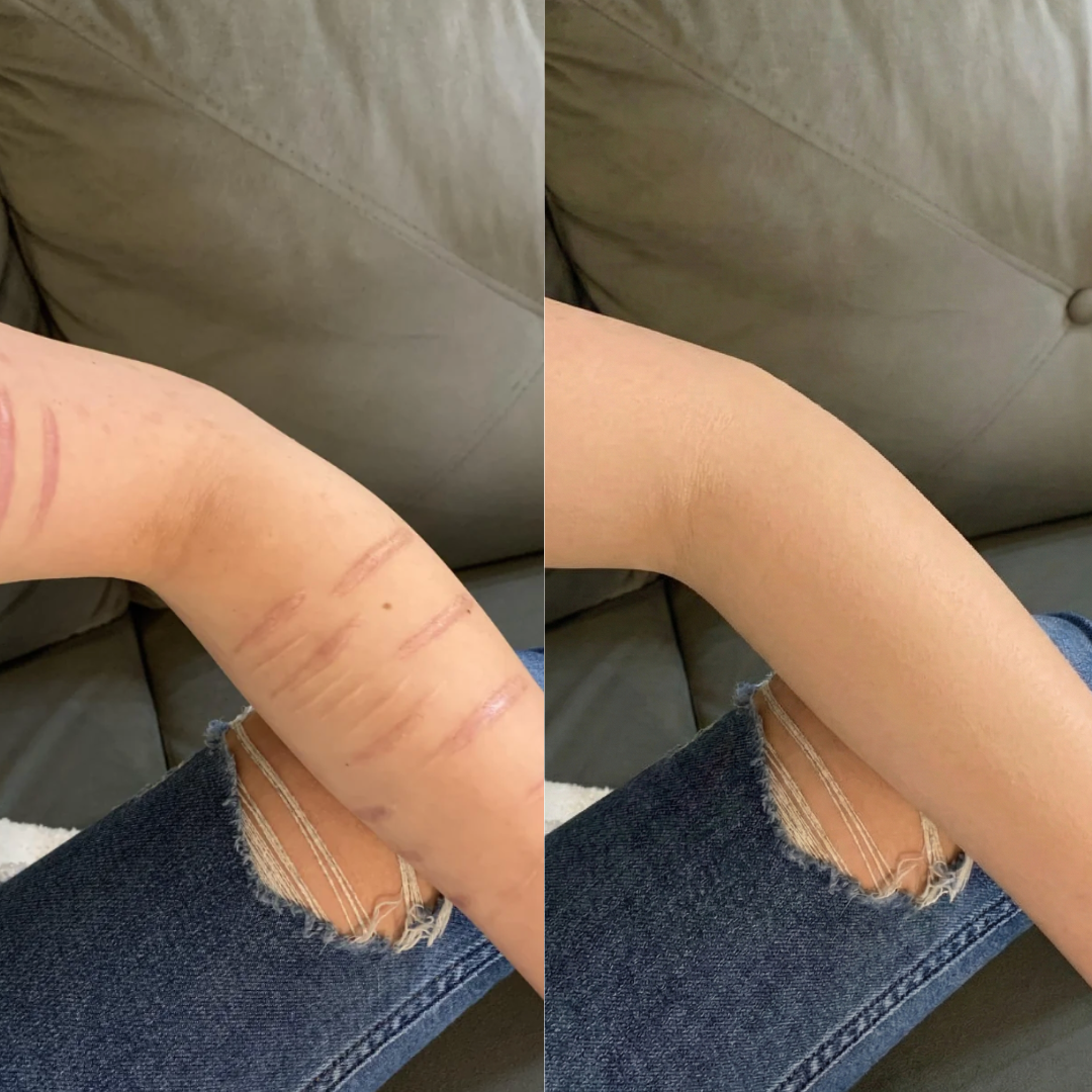 Covera Scar Concealer