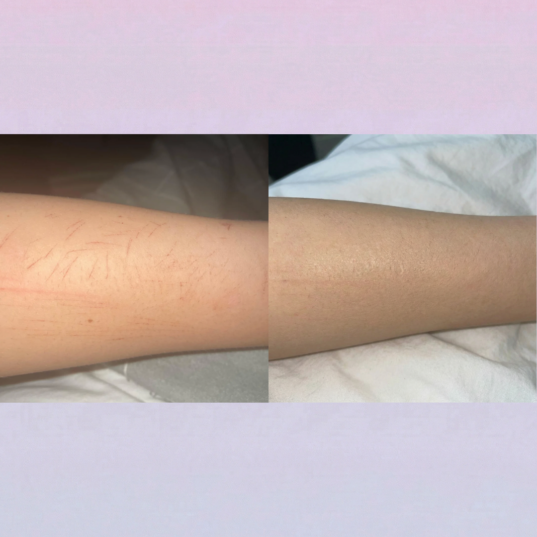 Covera Scar Concealer