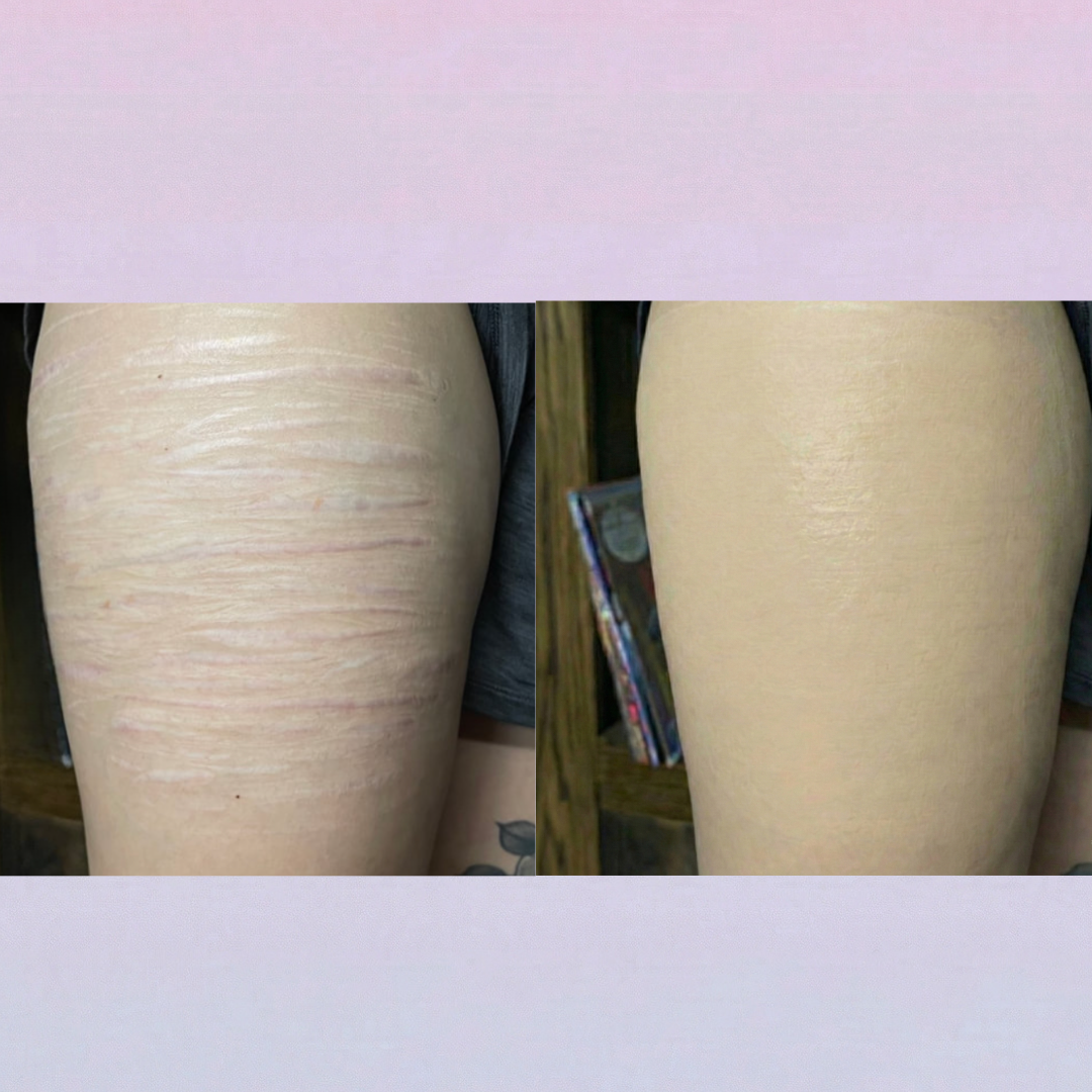 Covera Scar Concealer