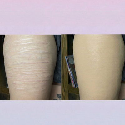 Covera Scar Concealer