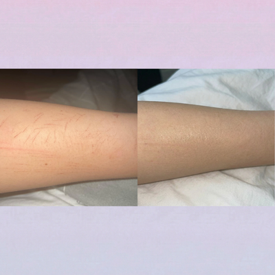 Covera Scar Concealer